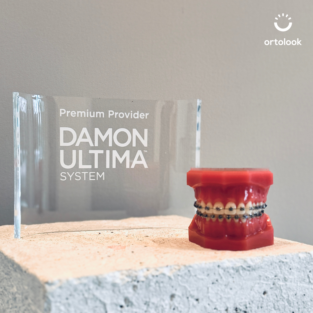 Model zubi s Damon Ultima aparatićem i nagrada Premium Provider za Ortolook ortodontsku ordinaciju.