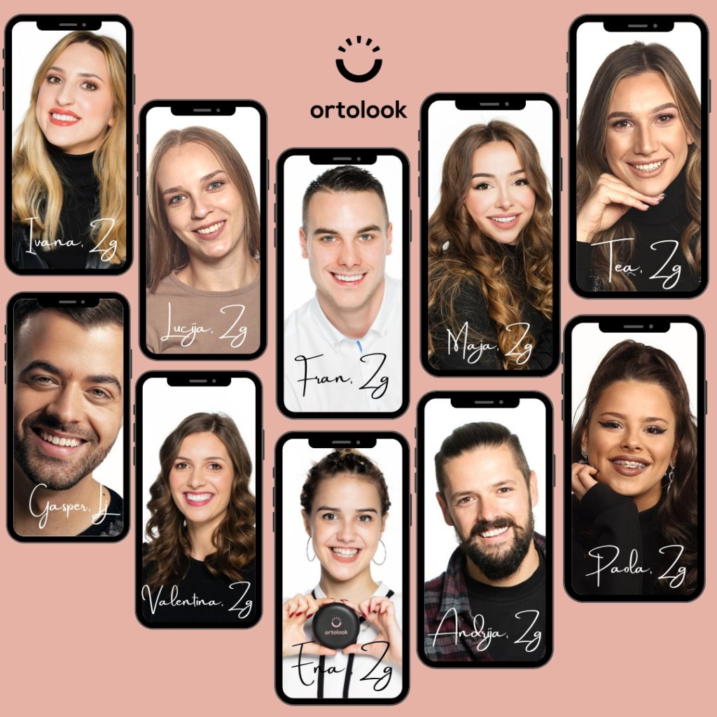 Plava-djevojka-nakon-skidanja-aparatica-Ortolook-Zagreb-Ortodoncija