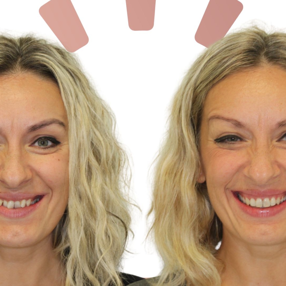 Smile-Longevity-velika-promjena-Ortolook-Zagreb-ortodoncija